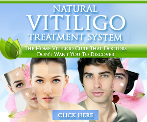 natural vitiligo treatment system